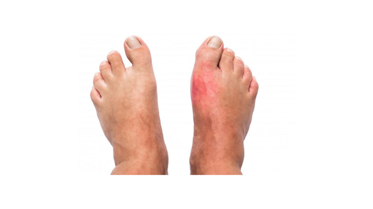 Picture for: Nerve Relief: Natural Solutions for Peripheral Neuropathy