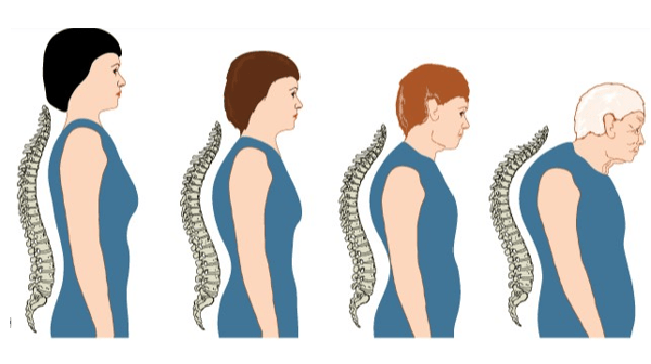 Course Posture & Osteoporosis Workshop: Building Better Bones image 1