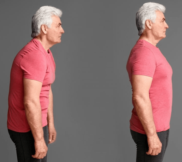 Picture for: Posture & Osteoporosis Workshop: Building Better Bones