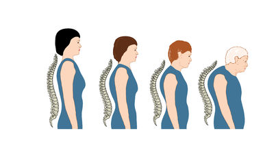 Picture for: Posture and Osteoporosis Workshop - Building Better Bones