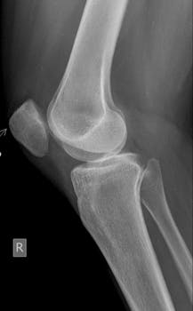 Picture for: Healthy Bones & Joints (55+)