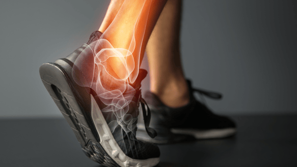 Course Feet, Knees & Ankles image 1