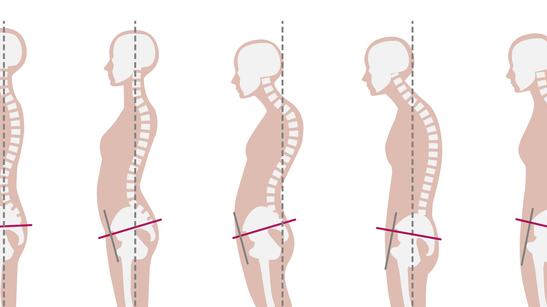 Picture for: Posture, Get It Straight! Look 10 years Younger, & Feel Better Than Ever