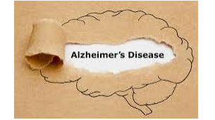 Picture for: Alzheimer's Series: Managing Money - A Caregiver's Guide to Finances