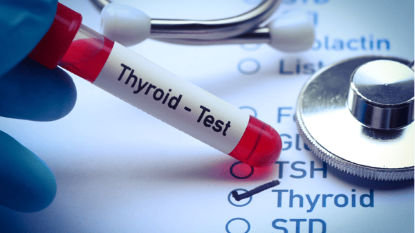 Picture for: Thyroid Things You Need To Know (Online Class)