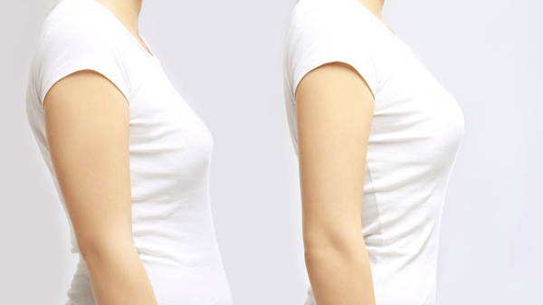 Picture for: Posture & Osteoporosis Workshop: Building Better Bones - Online