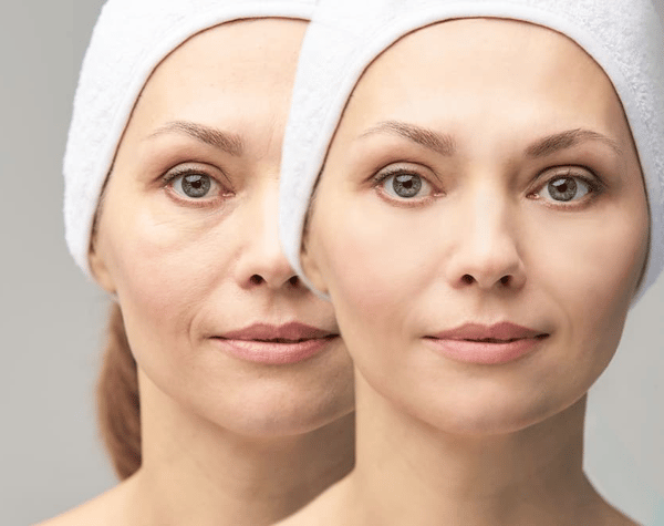 Course Facial skin rejuvenation image 1