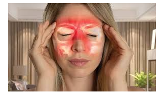 Picture for: Acupressure for Sinus Relief